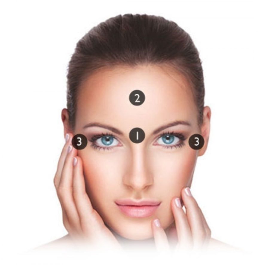 Botox injections areas